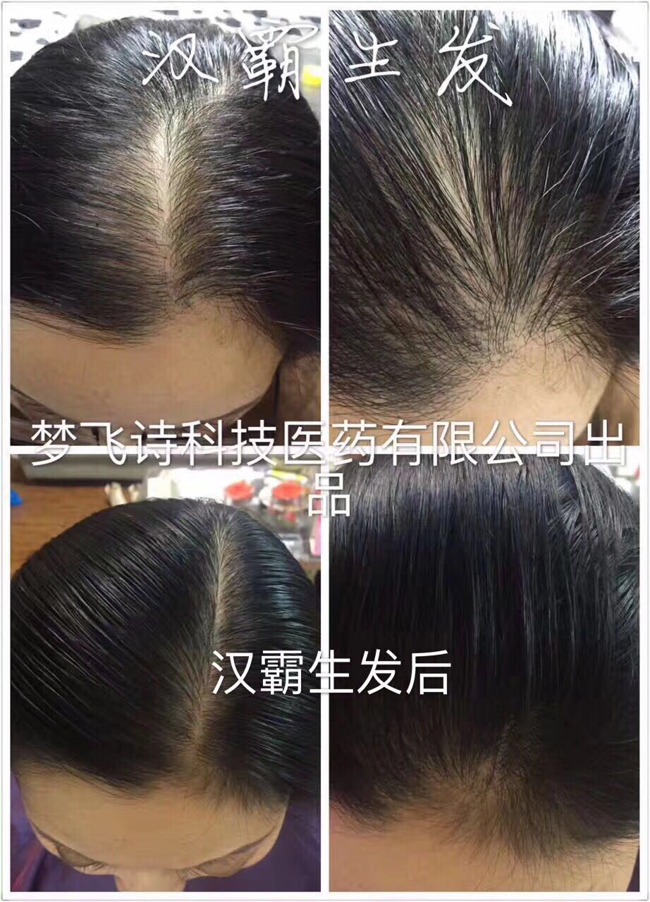 漢霸生發